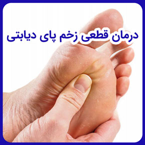 درمان قطعی زخم پای دیابتی و درمان زخم پای دیابتیک و درمان زخم انگشت پای دیابتی و آیا زخم پای دیابتی قابل درمان است و پماد درمان زخم پا دیابتی