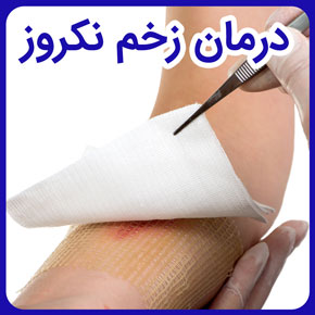 درمان زخم نکروز و زخم نکروز چیست و نکروز شدن زخم و نکروز و زخم بستر و زخم نکروز شده و زخم نکروز و روش های درمان آن و بافت زخم نکروز چیست