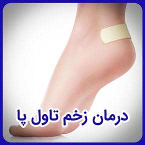 درمان زخم تاول پا و درمان سریع زخم تاول پا و درمان زخم و تاول پا و پماد برای زخم تاول پا و پانسمان زخم تاول و درمان تاول زخم پای دیابتی