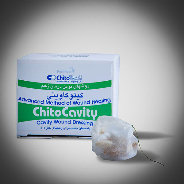 Postoperative-Fistula-Wound-Treatment-Ketocavity درمان زخم فیستول بعد از عمل و درمان زخم باز فیستول و درمان فیستول مقعدی و درمان فیستول با لیزر و پماد درمان فیستول مقعدی و درمان جوش فیستول - کیتوکاویتی